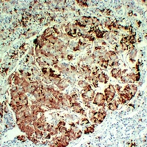 Prolactin Mouse Monoclonal Antibody(C2221)
