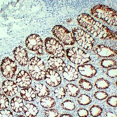 ALK5 Mouse Monoclonal Antibody(C2226)