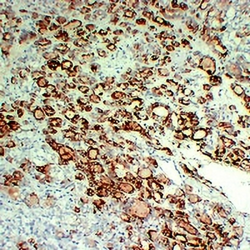 Thyroid Peroxidase Mouse Monoclonal Antibody(C2227)