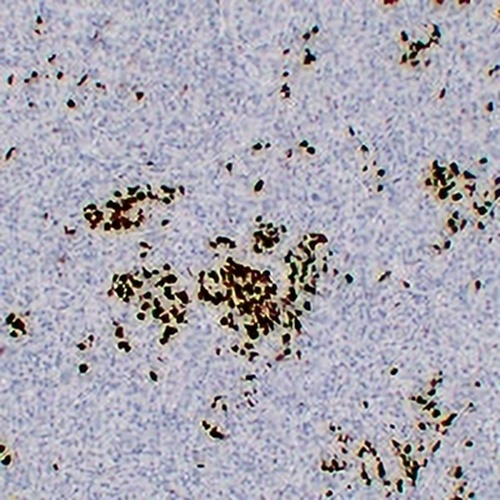 BOB1 Mouse Monoclonal Antibody(C2228)