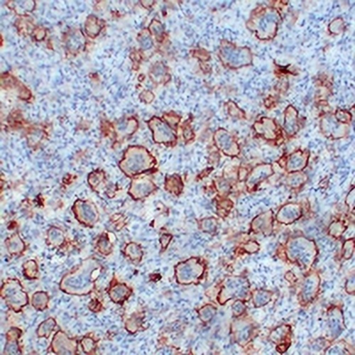 CD61 Mouse Monoclonal Antibody(C2231)