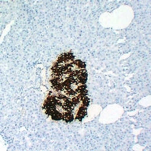 Insulin Mouse Monoclonal Antibody(C2233)
