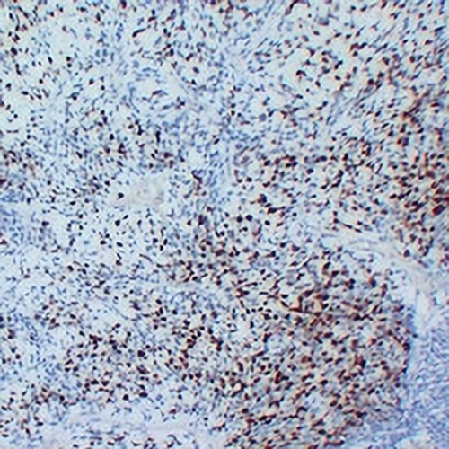 MYOG Mouse Monoclonal Antibody(C2236)