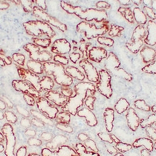 Von Hippel Lindau Mouse Monoclonal Antibody(C2237)