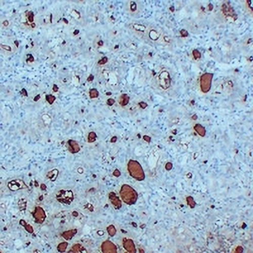 Thyroglobulin Mouse Monoclonal Antibody(C2238)