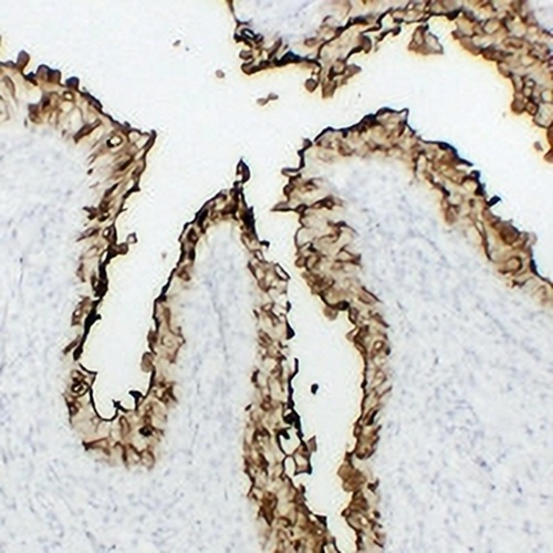 Uroplakin 3a Mouse Monoclonal Antibody(C2239)