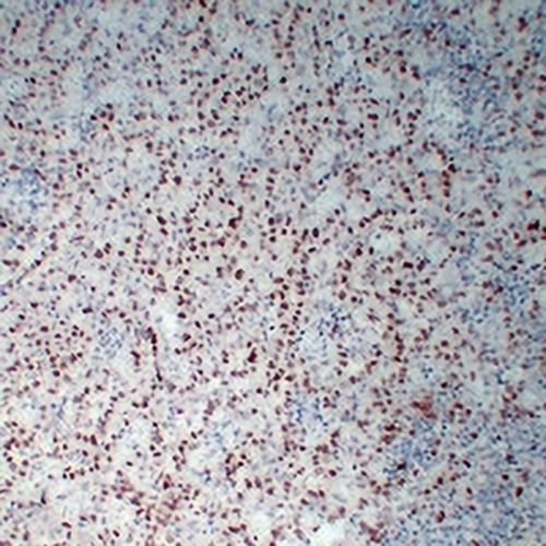 Wilms Tumor 1 Mouse Monoclonal Antibody(C2240)