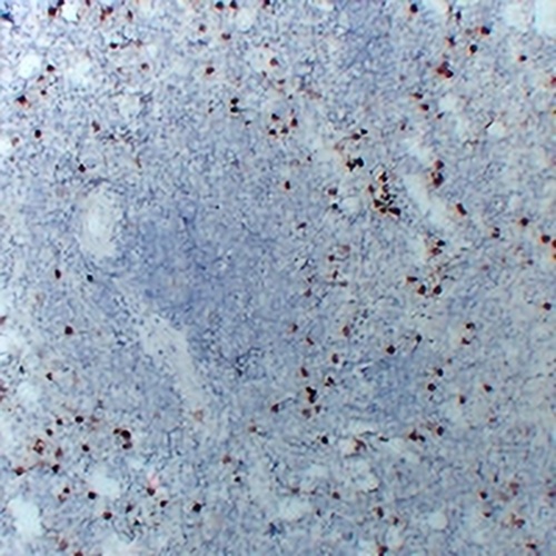 CD14 Mouse Monoclonal Antibody(C2245)