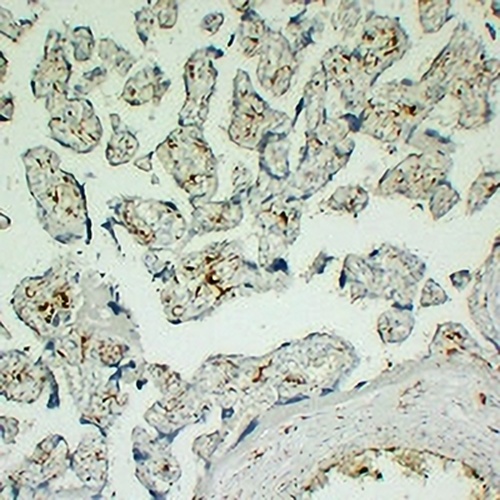 CD163 Mouse Monoclonal Antibody(C2246)