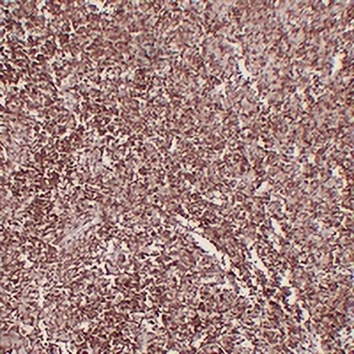 CD1a Mouse Monoclonal Antibody(C2247)