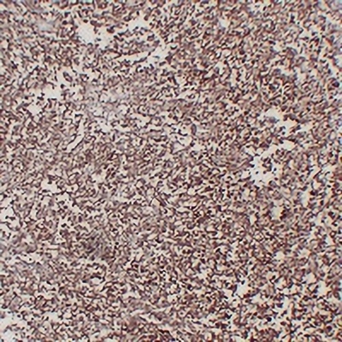 CD1a Mouse Monoclonal Antibody(C2248)