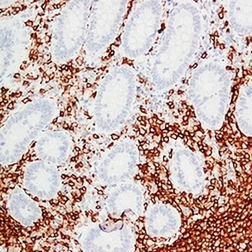 CD20 Mouse Monoclonal Antibody(C2249)