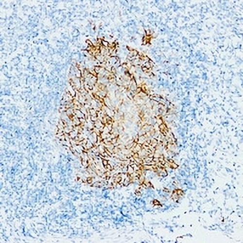 CD23 Mouse Monoclonal Antibody(C2250)