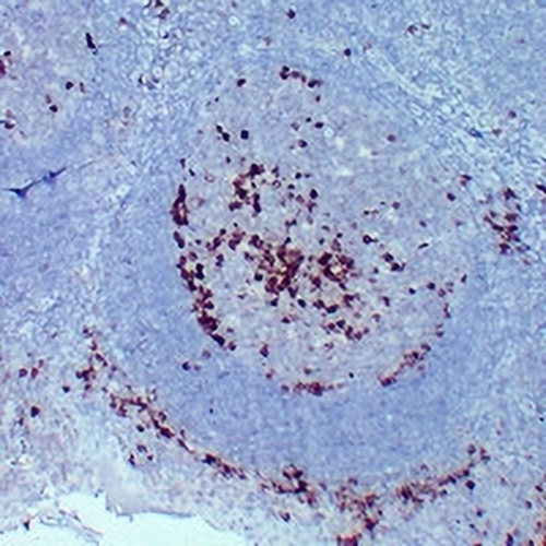 CD38 Mouse Monoclonal Antibody(C2252)