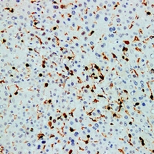 CD45 Mouse Monoclonal Antibody(C2255)