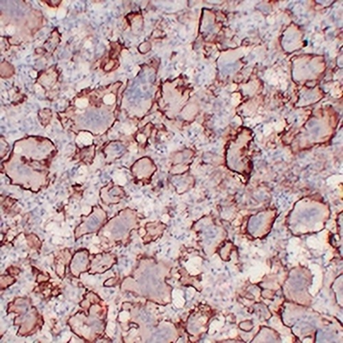 CD61 Mouse Monoclonal Antibody(C2257)