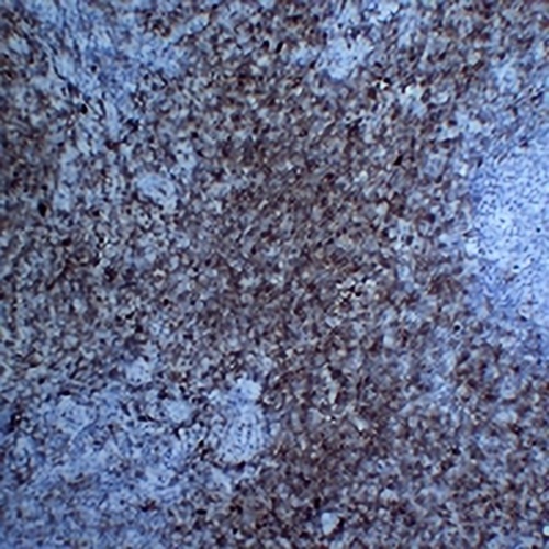 CD7 Mouse Monoclonal Antibody(C2258)