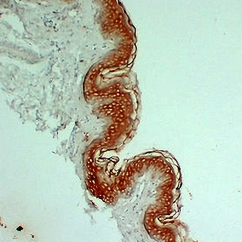 Cytokeratin 1 Mouse Monoclonal Antibody(C2259)
