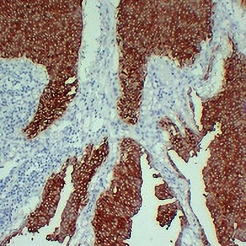 Cytokeratin 13 Mouse Monoclonal Antibody(C2260)