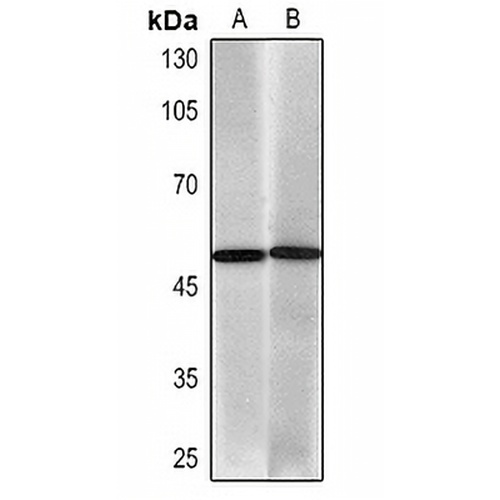 Cytokeratin 17 Mouse Monoclonal Antibody(C2263)