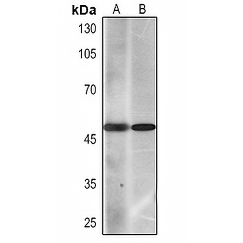 Cytokeratin 7 Mouse Monoclonal Antibody(C2267)