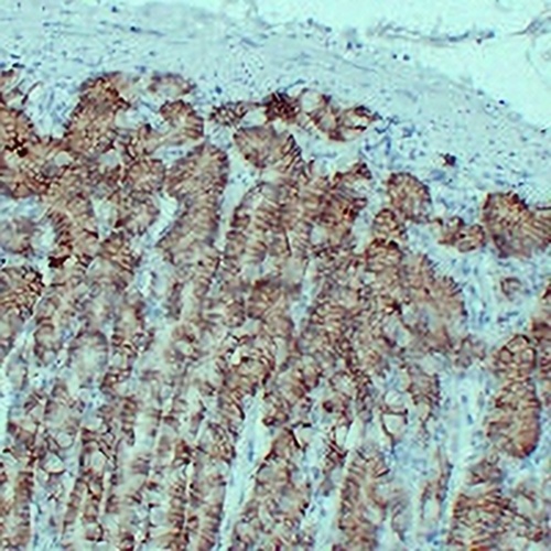 Claudin 18 Mouse Monoclonal Antibody(C2269)