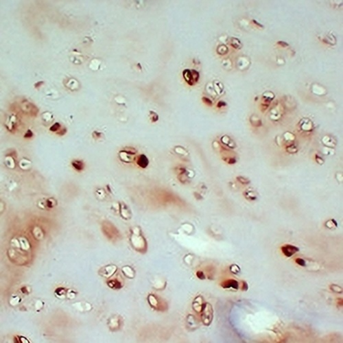 Collagen 2 alpha 1 Mouse Monoclonal Antibody(C2271)