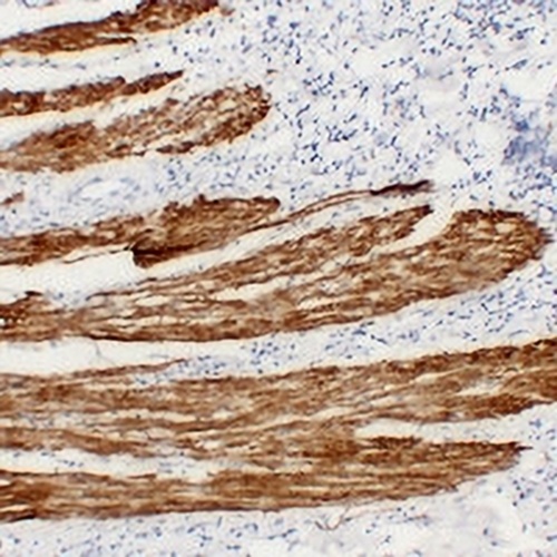 Desmin Mouse Monoclonal Antibody(C2272)