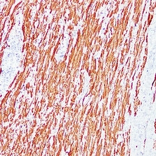 Desmin Mouse Monoclonal Antibody(C2273)
