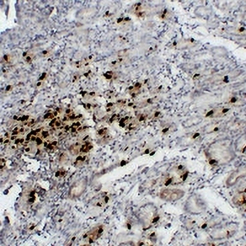 Gastrin Mouse Monoclonal Antibody(C2275)