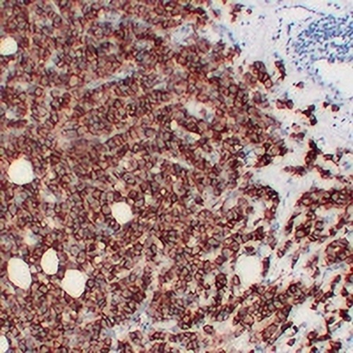 HER2 Mouse Monoclonal Antibody(C2279)