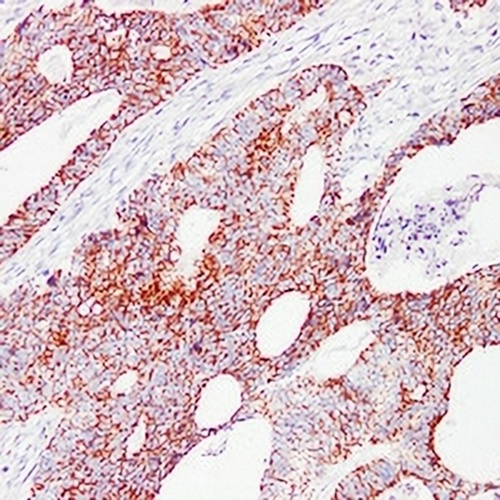 HSP60 Mouse Monoclonal Antibody(C2280)