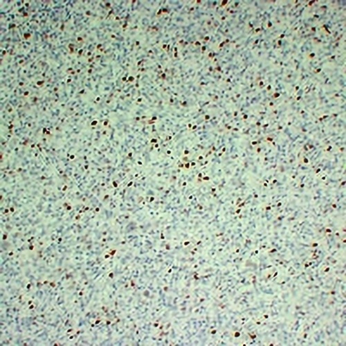 Ki67 Mouse Monoclonal Antibody(C2281)