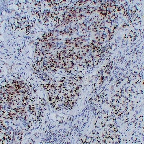 MYOG Mouse Monoclonal Antibody(C2292)
