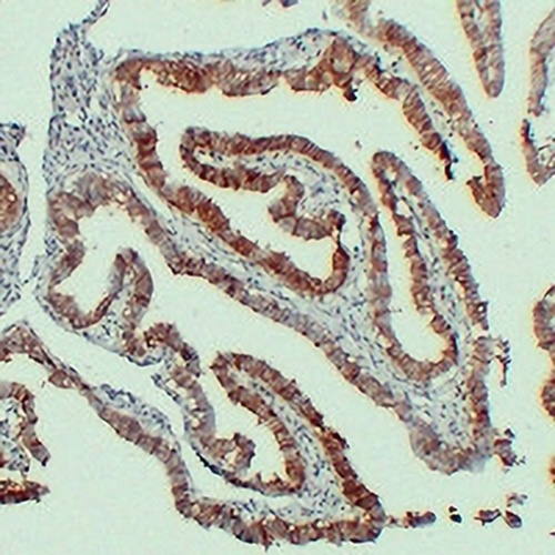 CD325 Mouse Monoclonal Antibody(C2293)