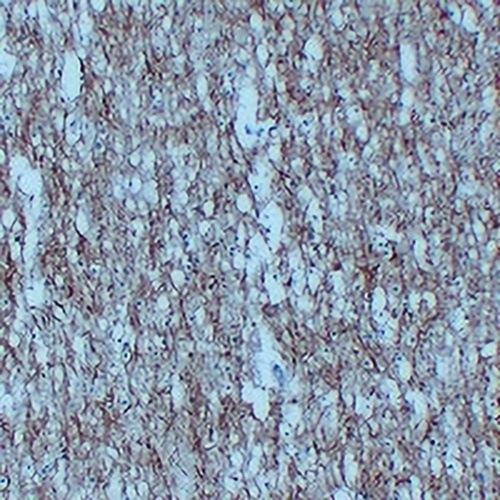 NEFL Mouse Monoclonal Antibody(C2294)