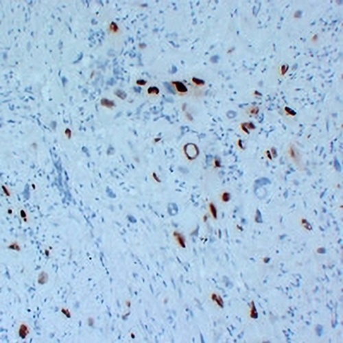p57 Kip2 Mouse Monoclonal Antibody(C2295)