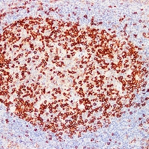 CD279 Mouse Monoclonal Antibody(C2298)