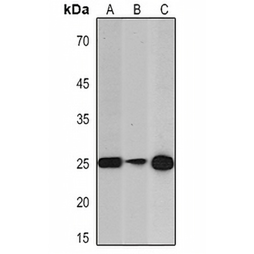 PGP9.5 Mouse Monoclonal Antibody(C2299)