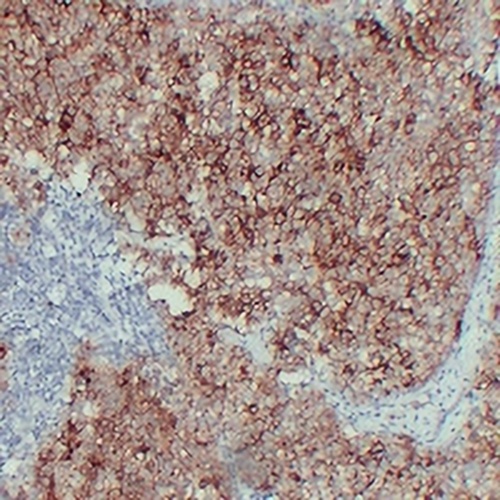 ALPP Mouse Monoclonal Antibody(C2300)