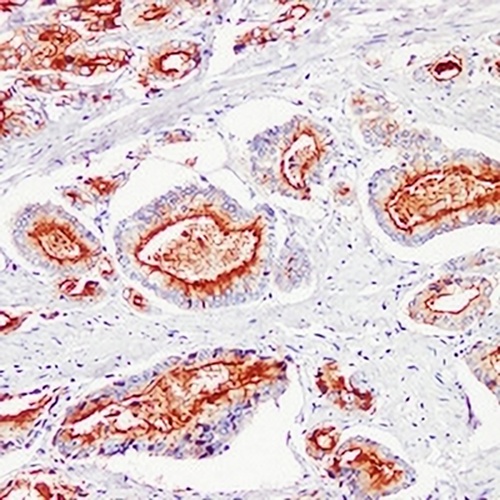 Kallikrein 3 Mouse Monoclonal Antibody(C2302)