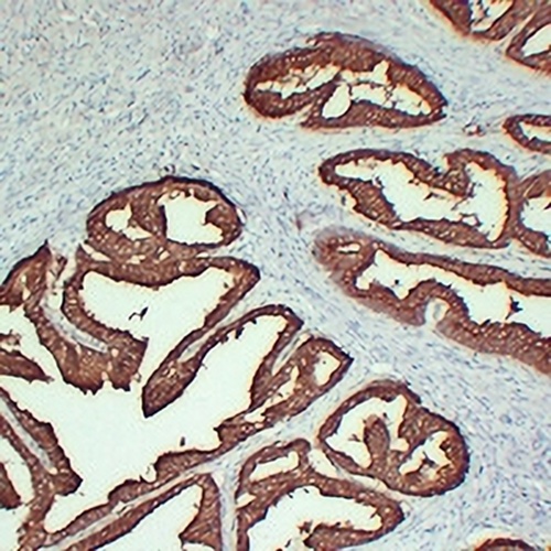 TMPase Mouse Monoclonal Antibody(C2303)