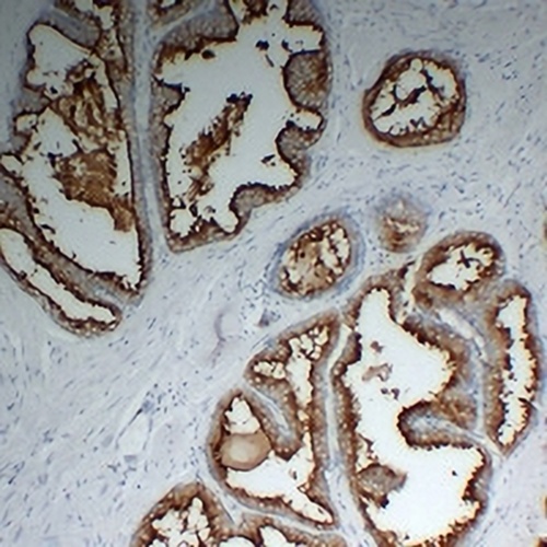 PSMA Mouse Monoclonal Antibody(C2304)