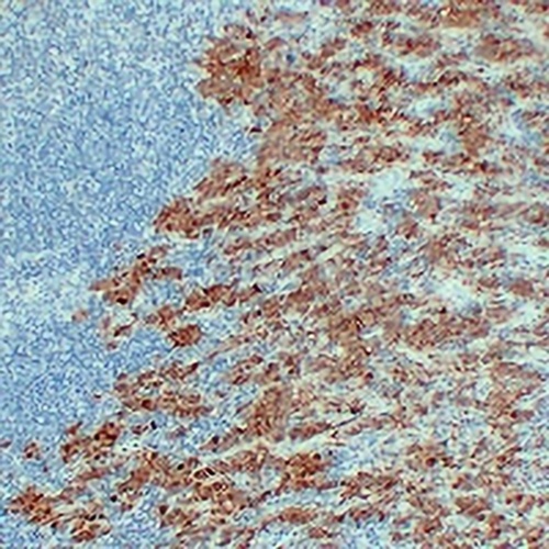 S100-A1 Mouse Monoclonal Antibody(C2306)