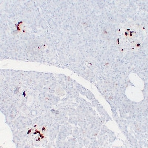 Somatostatin Mouse Monoclonal Antibody(C2307)