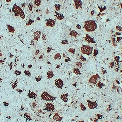 ACP5 Mouse Monoclonal Antibody(C2308)
