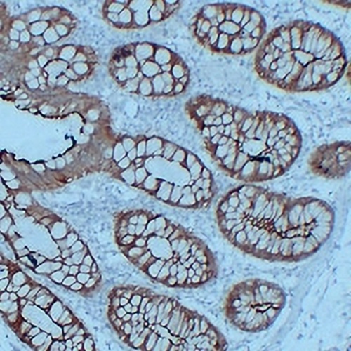 Villin Mouse Monoclonal Antibody(C2310)