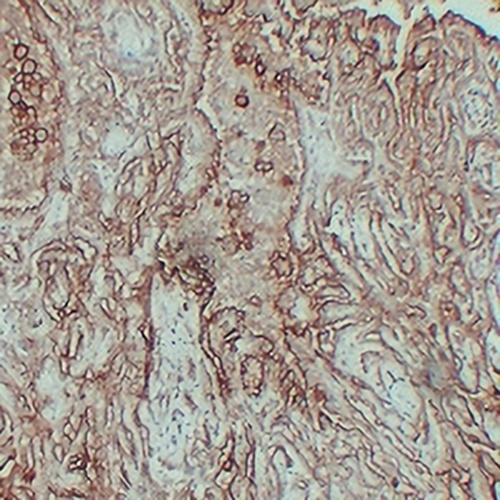 MUC16 Mouse Monoclonal Antibody(C2311)