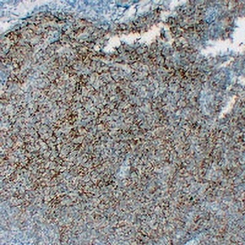 CD35 Mouse Monoclonal Antibody(C2315)