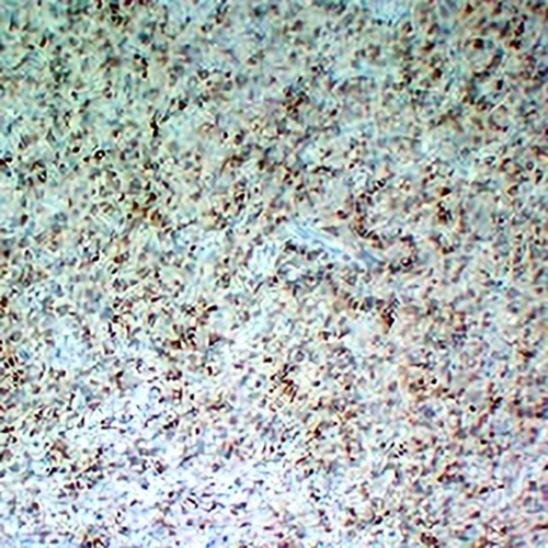 CD5 Mouse Monoclonal Antibody(C2317)